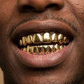 Gold Full-Coverage Grillz