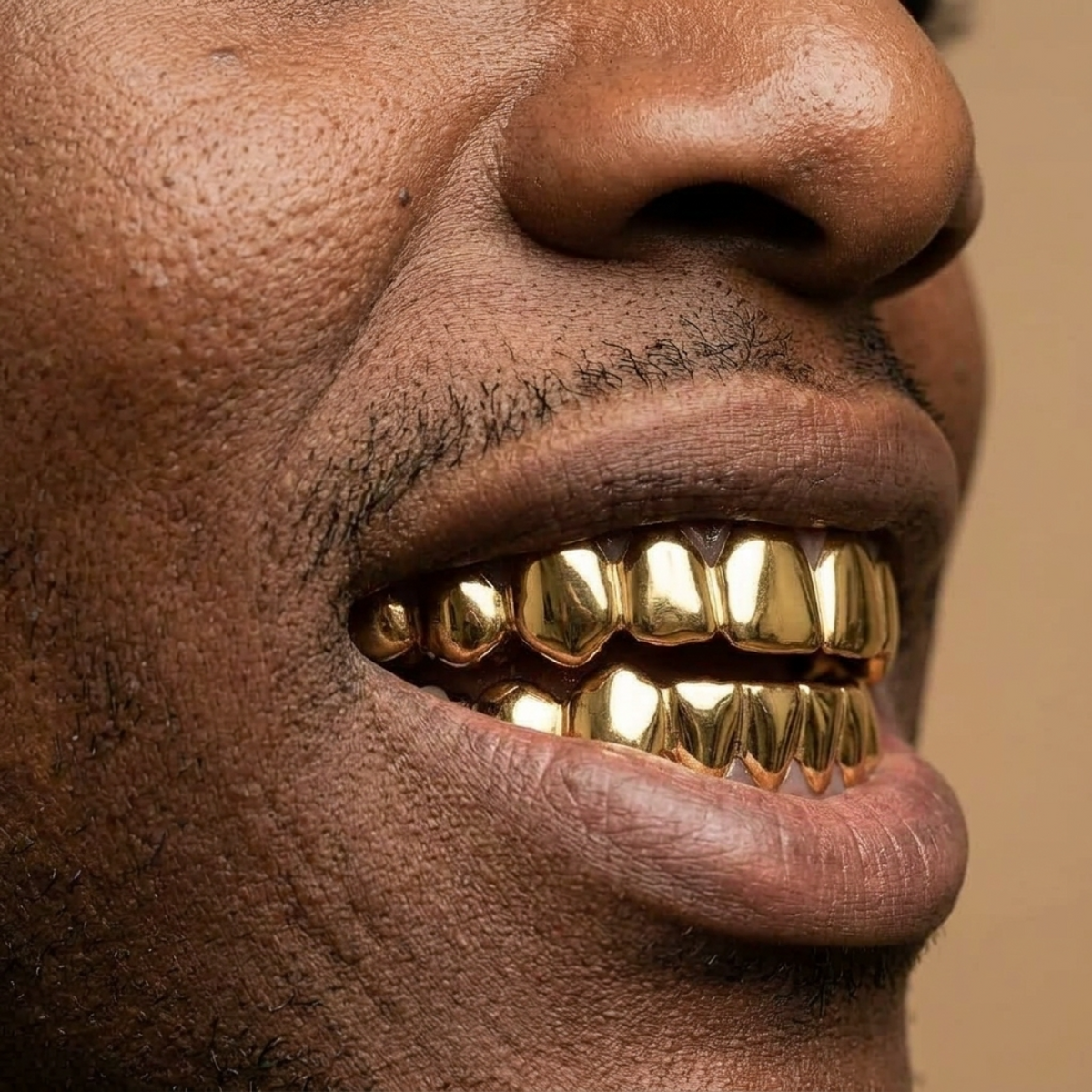 Gold Full-Coverage Grillz